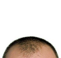 bald-head_.jpg